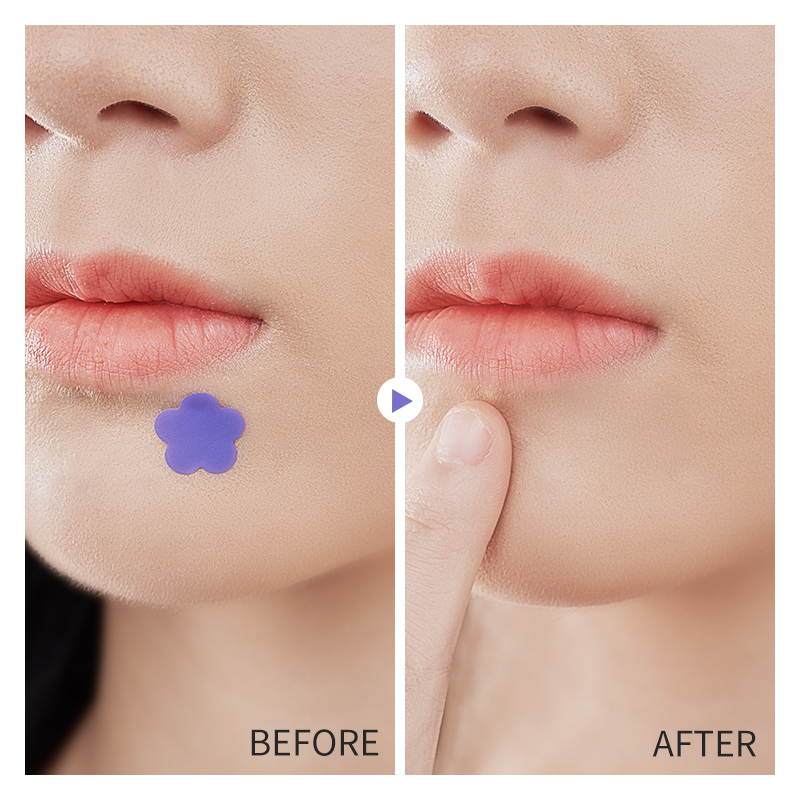 痘痘贴详情 (5)_OkLWNwCB.jpg